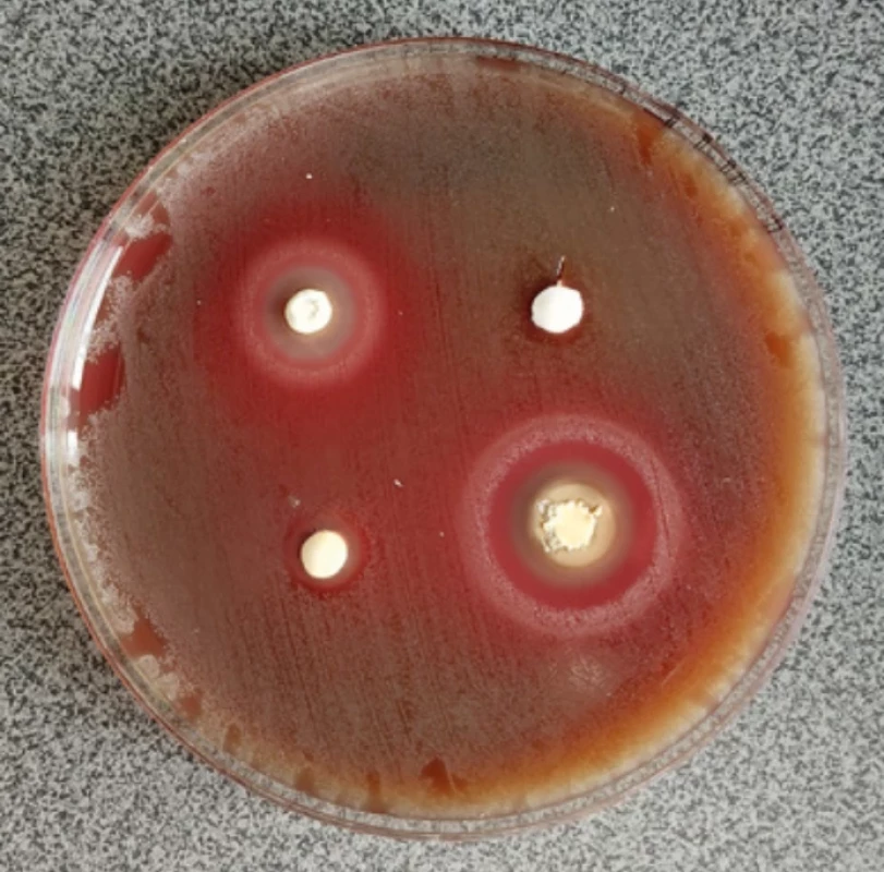 Kultivace viridujících streptokoků, zřetelné inhibiční zóny u materiálů TheraCal LC, TheraCal PT a Biodentine. Fig. 2 Viridans streptococci culture showing inhibition zones around TheraCal LC, TheraCal PT, and Biodentine.