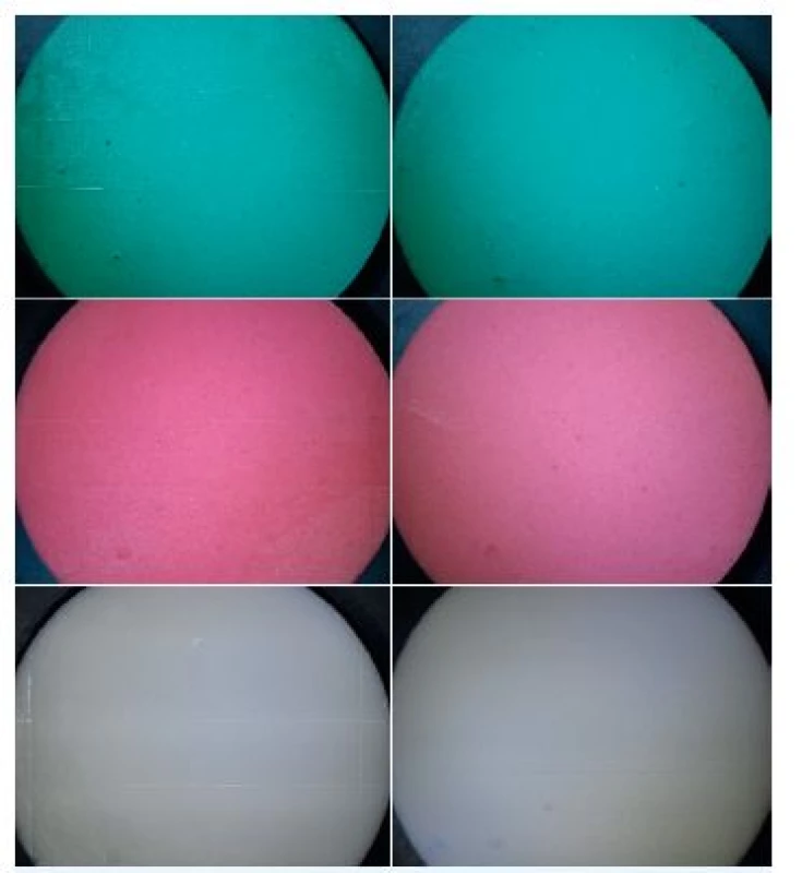 Reprodukční vlastnosti alginátových otiskovacích hmot. Kontrolní vzorky (vlevo) a zkušební vzorky po dezinfekci v přípravku Dentaclean Form (vpravo); nahoře – otiskovací hmota Ypeen, uprostřed – otiskovací hmota Alligat fast set, dole – otiskovací hmota Elastic Cromo; zvětšení 6,3x