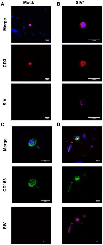 SIV antigens in semen CD4<sup>+</sup> T cells and macrophages.