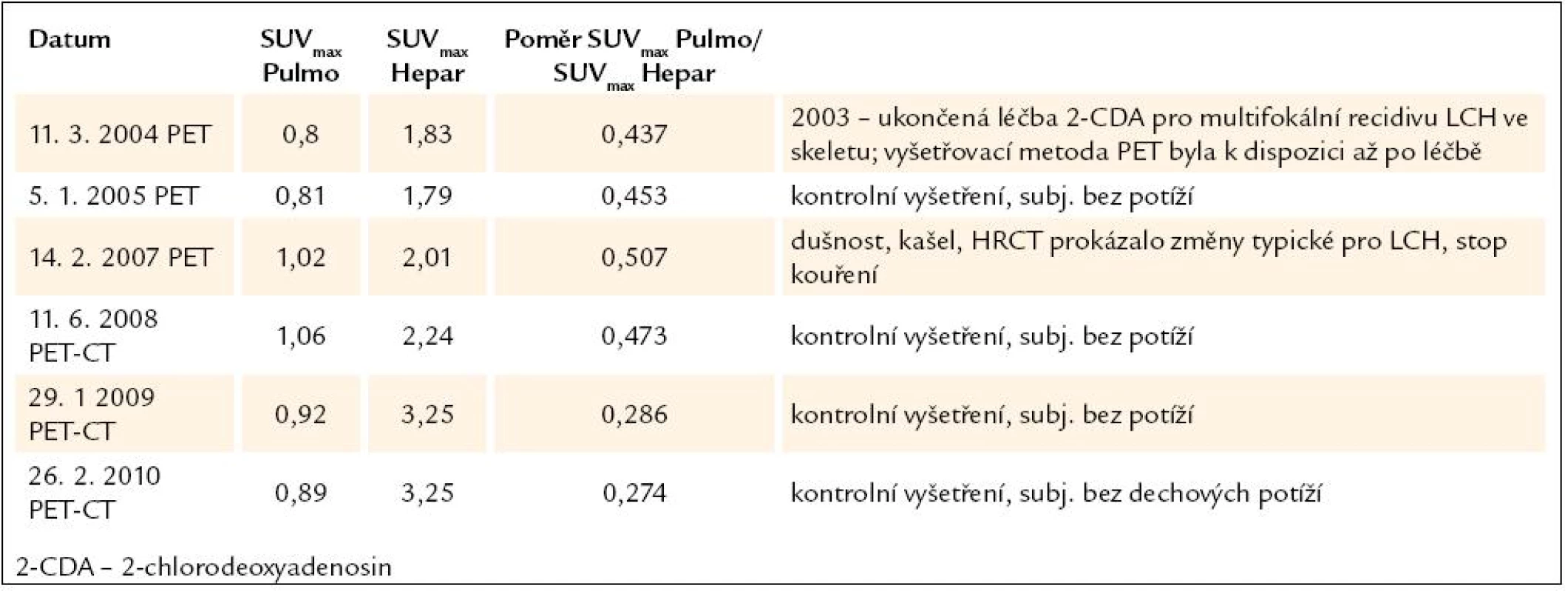 Vývoj plicní aktivity při PET-CT vyšetření u 2. pacienta, nar. 1972.