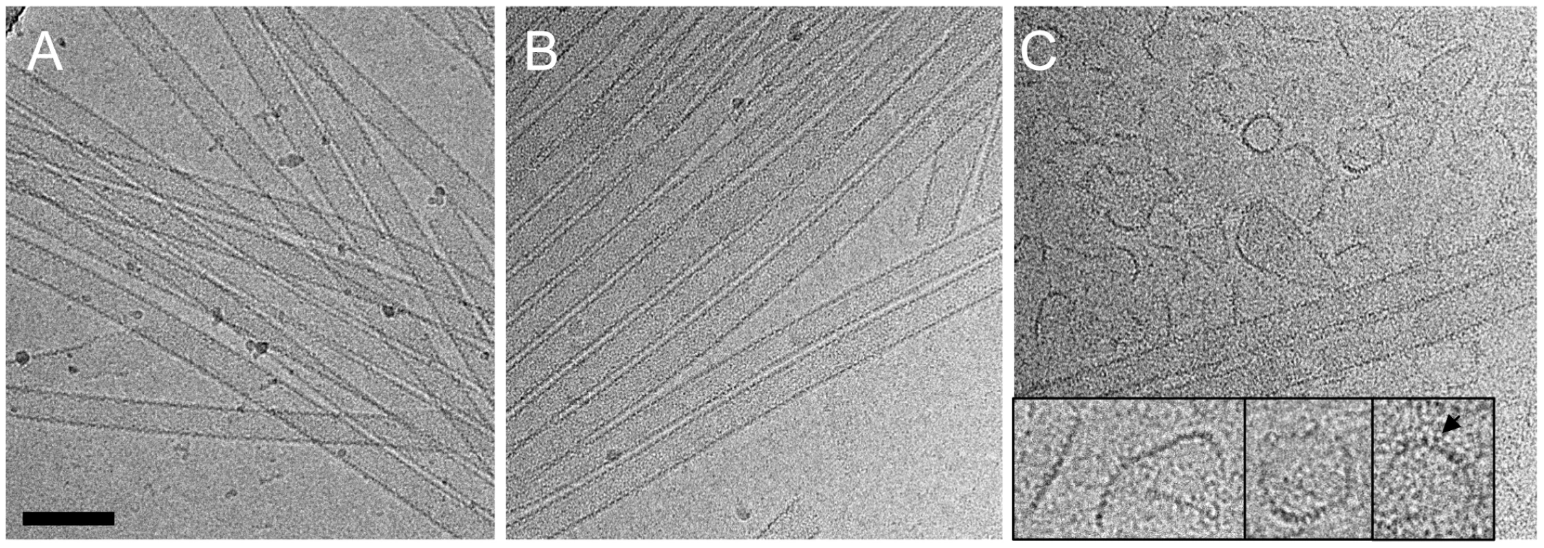 CryoEM analysis of the TRIM5α CC-SPRY interaction with wild-type CA tubes.