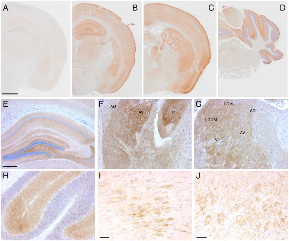 Tg(FFI) mice show cerebral accumulation of protease-resistant PrP.
