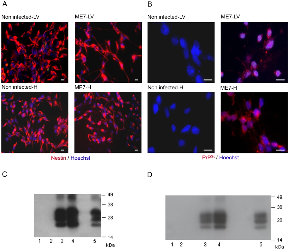 Neural precursor cells isolated from infected mice accumulate PrP<sup>Sc</sup>.