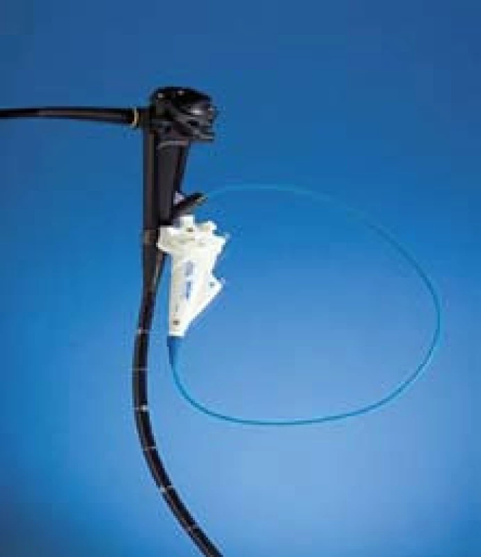 SpyScope upevněný na terapeutický duodenoskop.
Fig. 2. SpyScope attached to therapeutic duodenoscope.