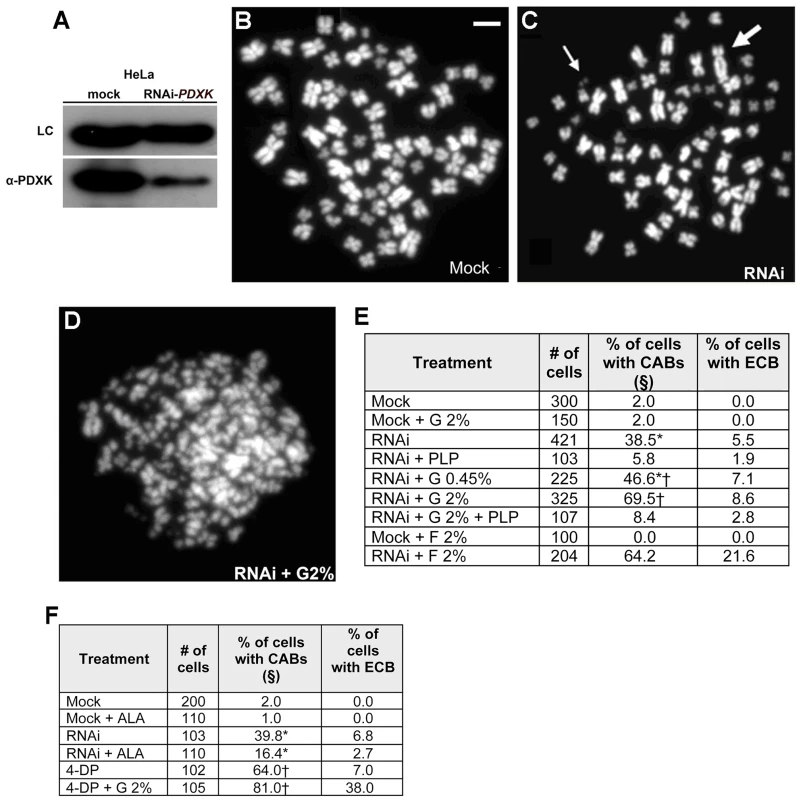 PLP deficiency causes CABs in HeLa cells.