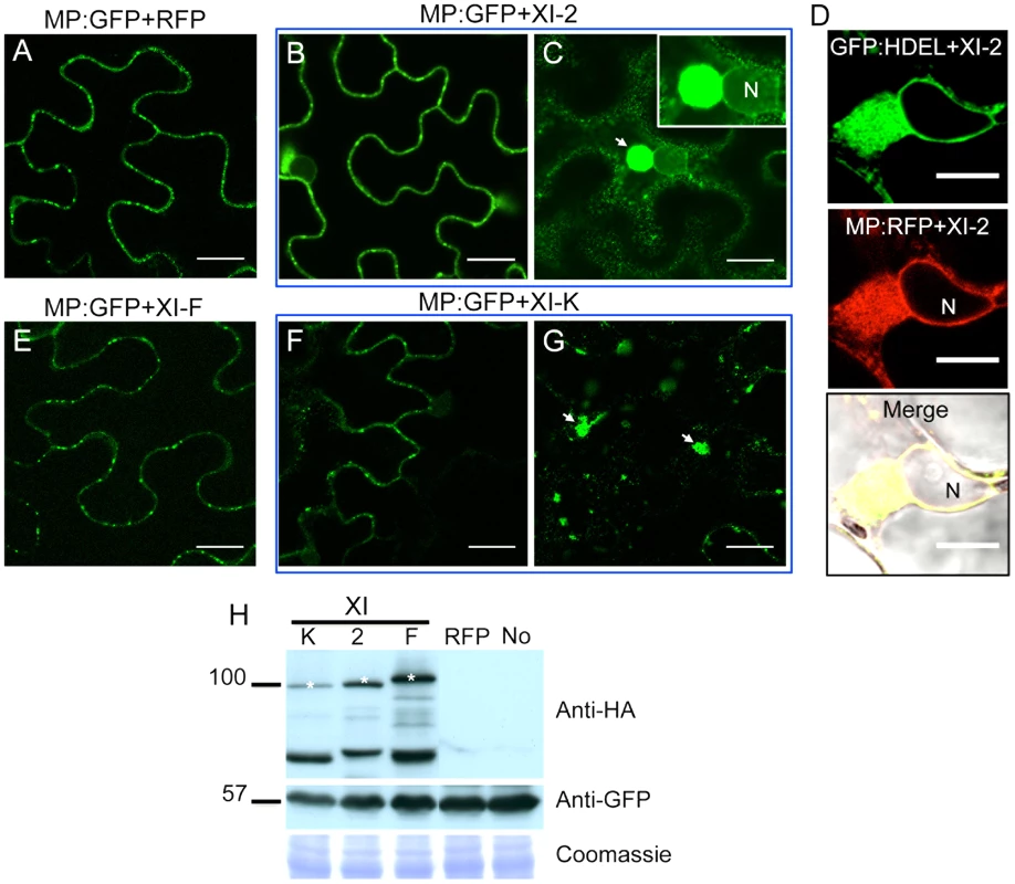 Transient expression of myosin XI-2 and XI-K tails changes the accumulation pattern of the MP.