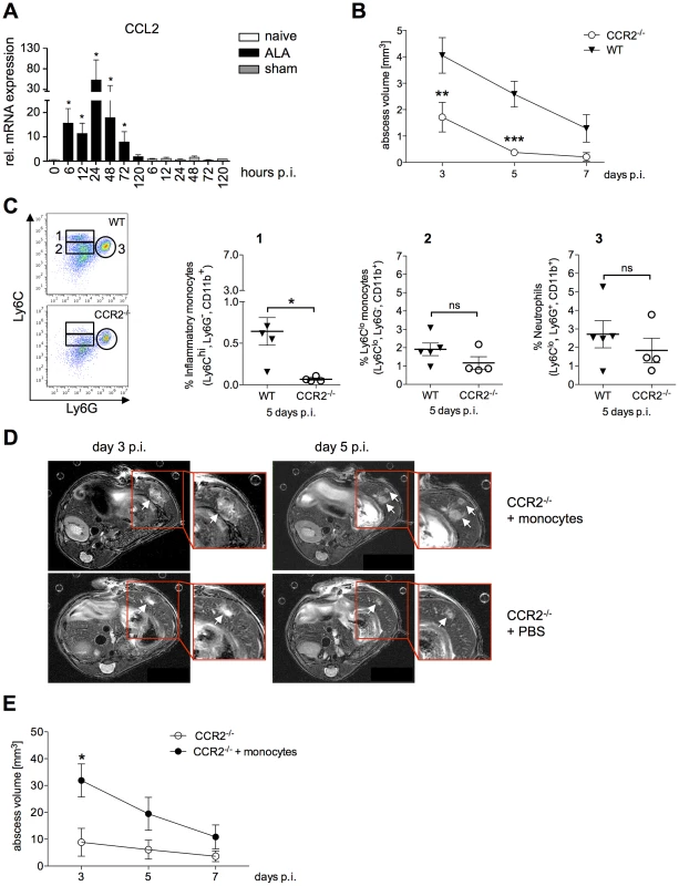 Role of Ly6C<sup>hi</sup> inflammatory monocytes in abscess formation.