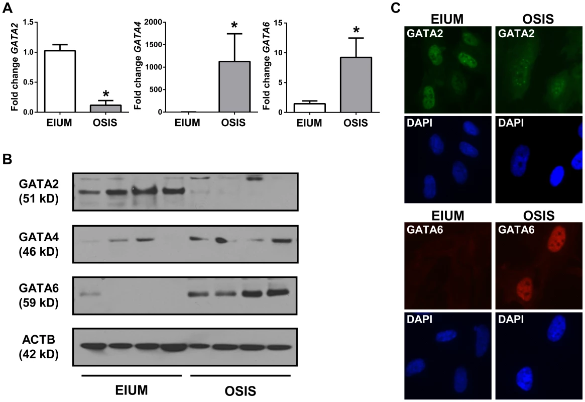 GATA isoform expression in stromal cells.