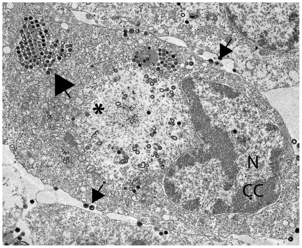FV3-infected fathead minnow (FHM) cells.