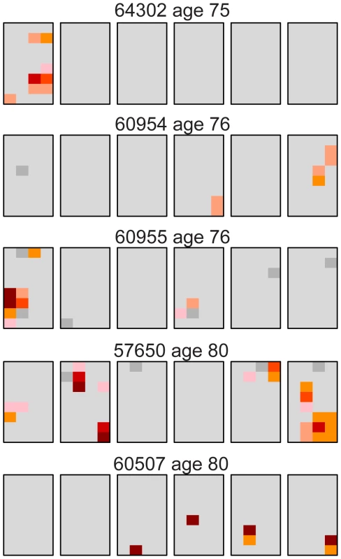 Distribution of the Apert syndrome c.755C>G mutation for the oldest age group (75–80 years).