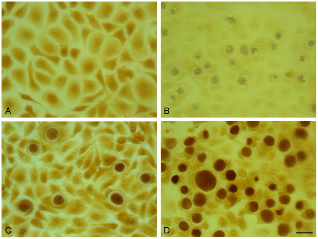 Acquisition of the plasmid pGFP::SW2 restores the ability of plasmid-free <i>C. trachomatis</i> L2 (25667R) to synthesize glycogen.