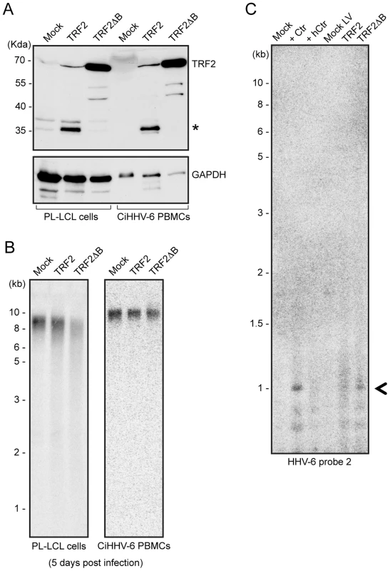 TRF2ΔB overexpression induces formation of circular HHV-6 genome in ciHHV-6 cells.