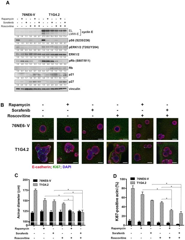 Combination drug treatment prevents induction of aberrant acinar development by LMW-E.
