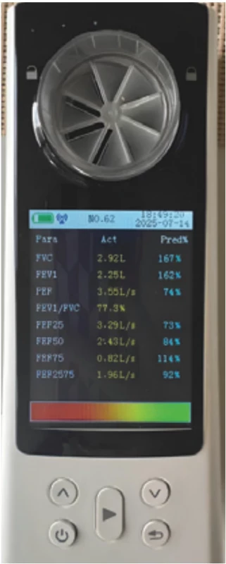 Používaný lékařský spirometr. Fig. 1. Medical spirometer used.