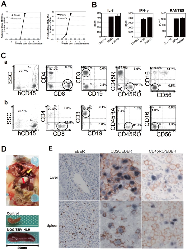 Engraftment of EBV-infected T and B cells in NOG mice transplanted with PBMC of patients with EBV-HLH.