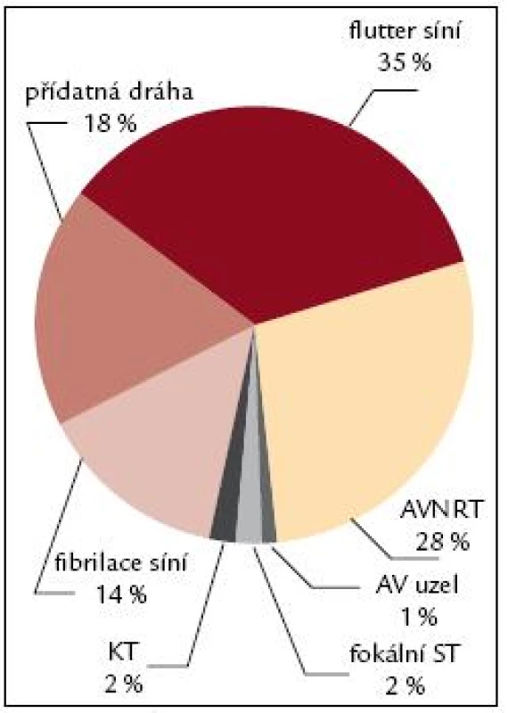Spektrum RFA 2005.
Vysvětlivky viz. obr. 7.