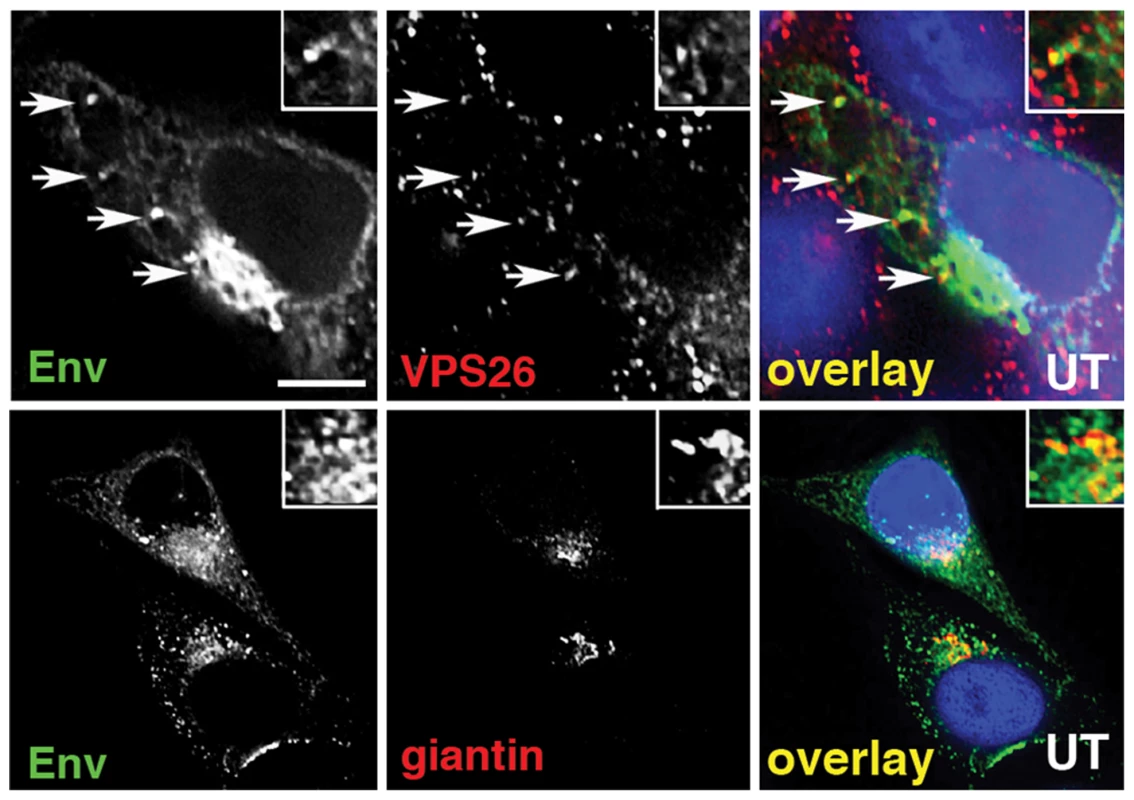 Immunofluorescence staining of Env in HIV-1 infected cells.