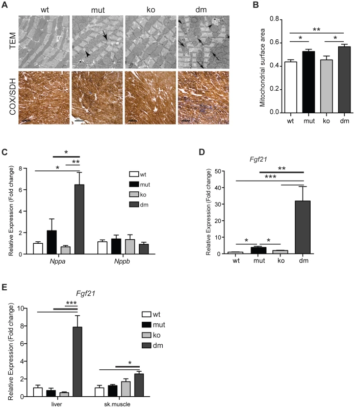 Characterization of mitochondrial cardiomyopathy in wild type (wt), mtDNA mutator (mut), UCP2-deficient wild type (ko) and mtDNA mutator (dm) mice.