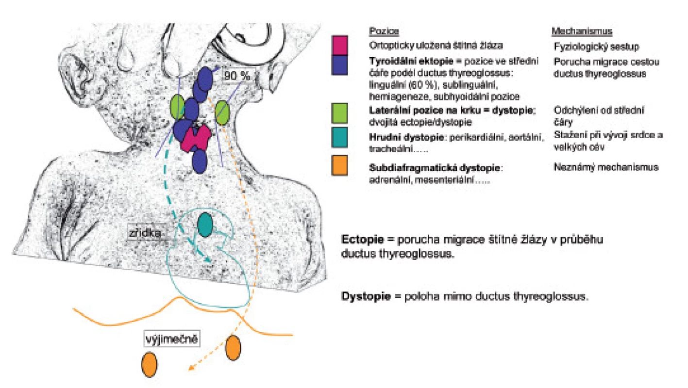 Poruchy migrace a morfologického vývoje štítné žlázy.
