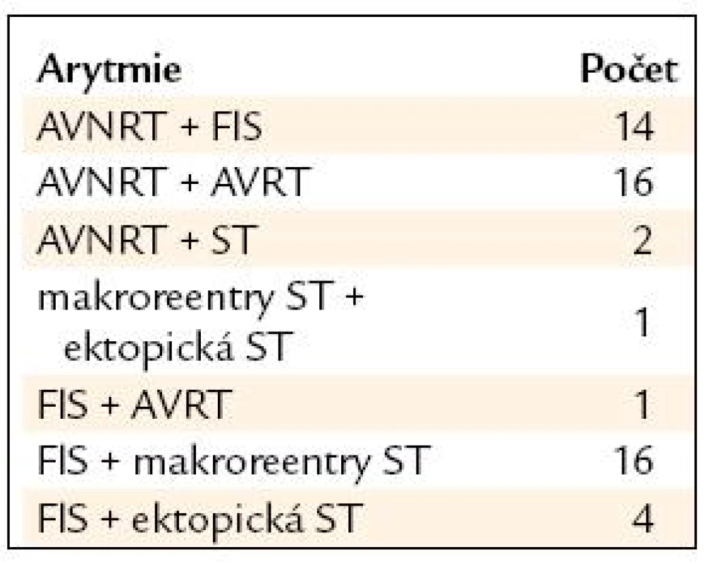 Katetrizační ablace u kombinace arytmií (n = 54).