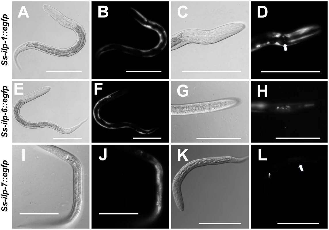 <i>S. stercoralis</i> ILP promoters are active in the nervous system and other tissues.