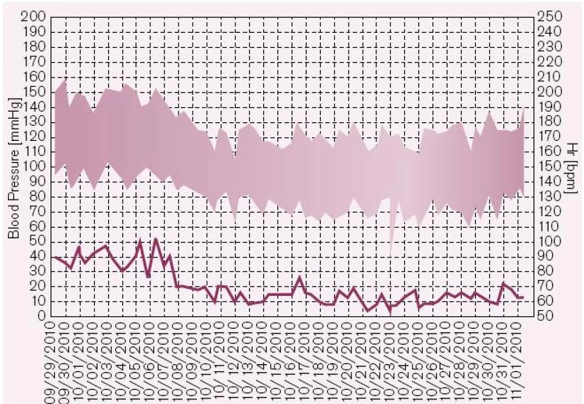 Vývoj hodnot TK a pulzu u pacientky s maskovanou hypertenzí. Před úpravou medikace jsou průměrné domácí hodnoty tlaku 144,7/93,3 mmHg, po úpravě terapie 123,2/73,5 mmHg. Hodnoty TK v ordinaci byly vždy v normě.