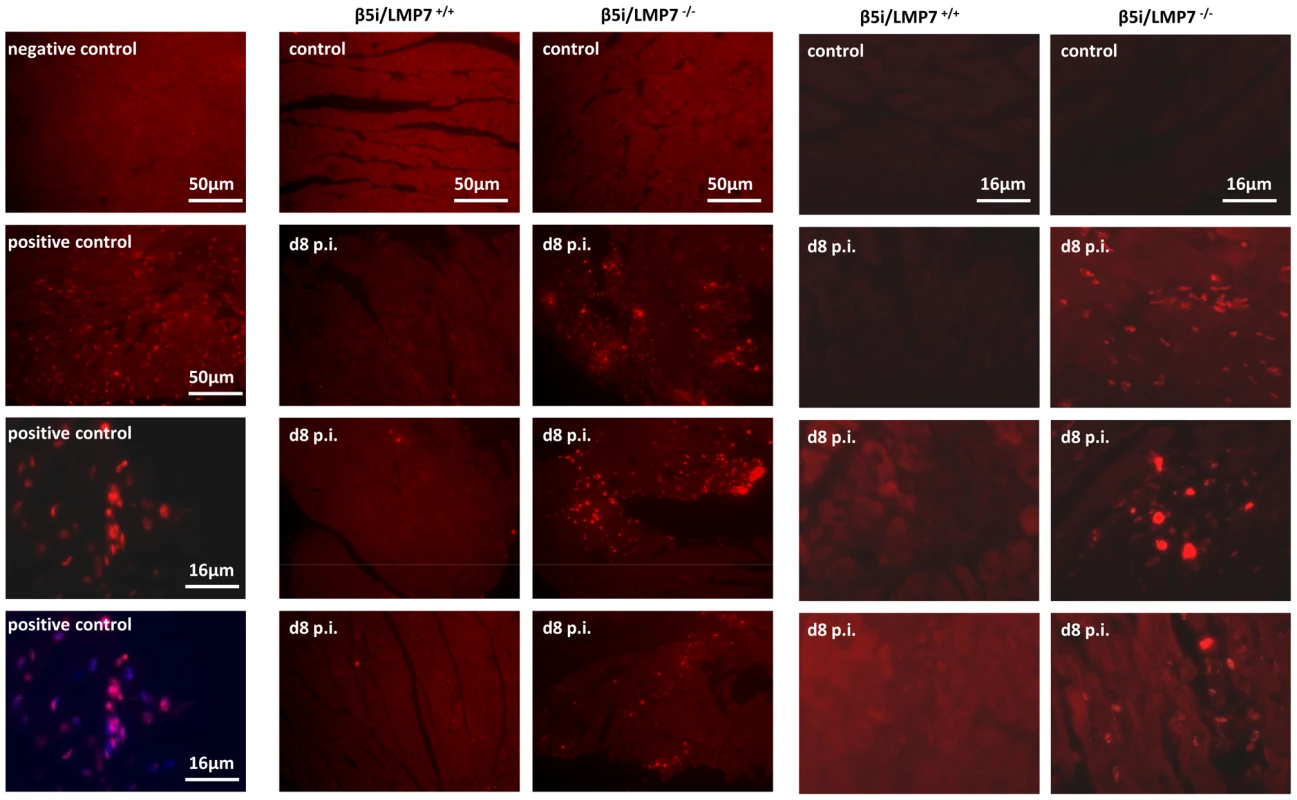 IP-deficient hearts are prone to apoptotic cell death.