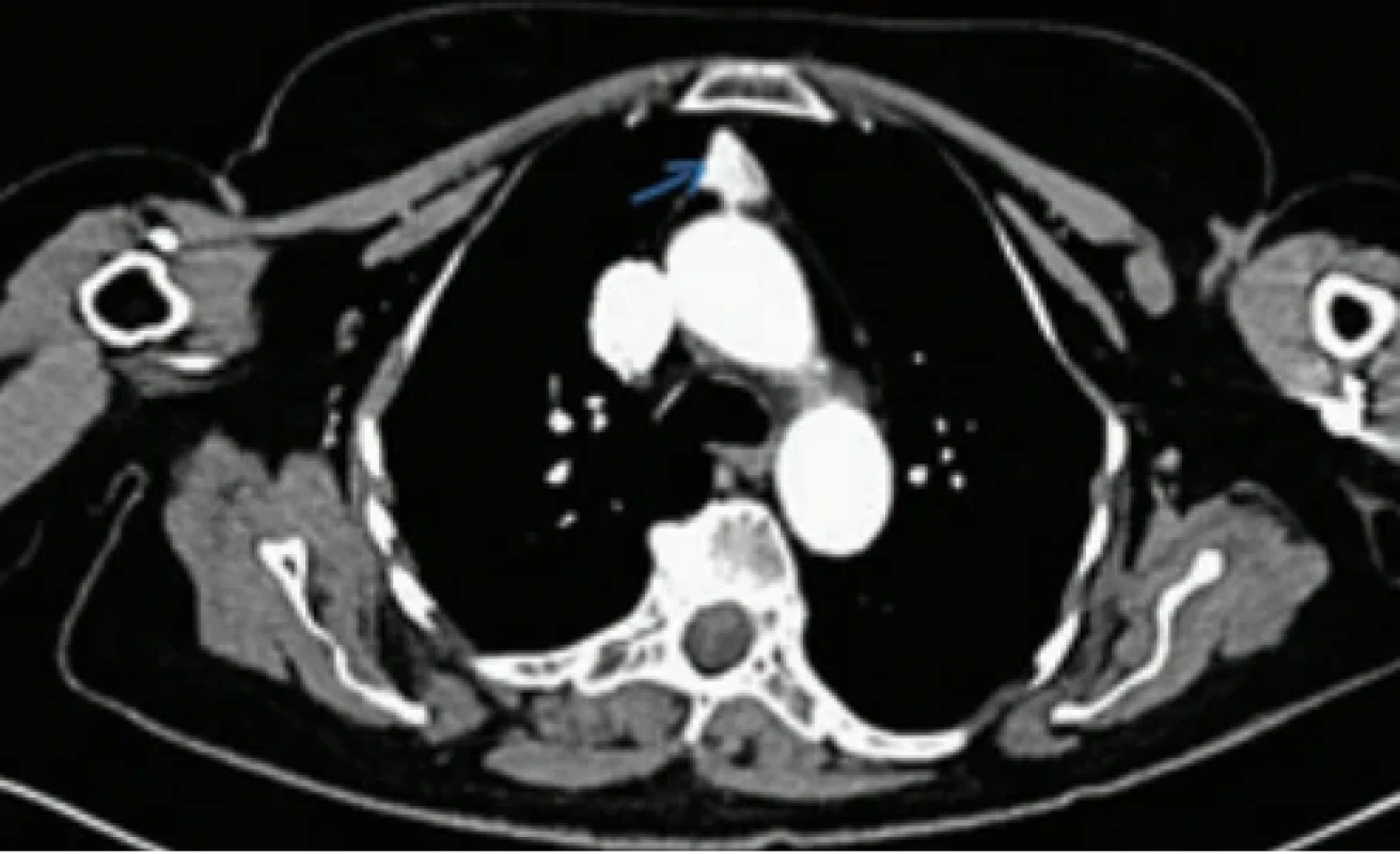  / Fig. 4.