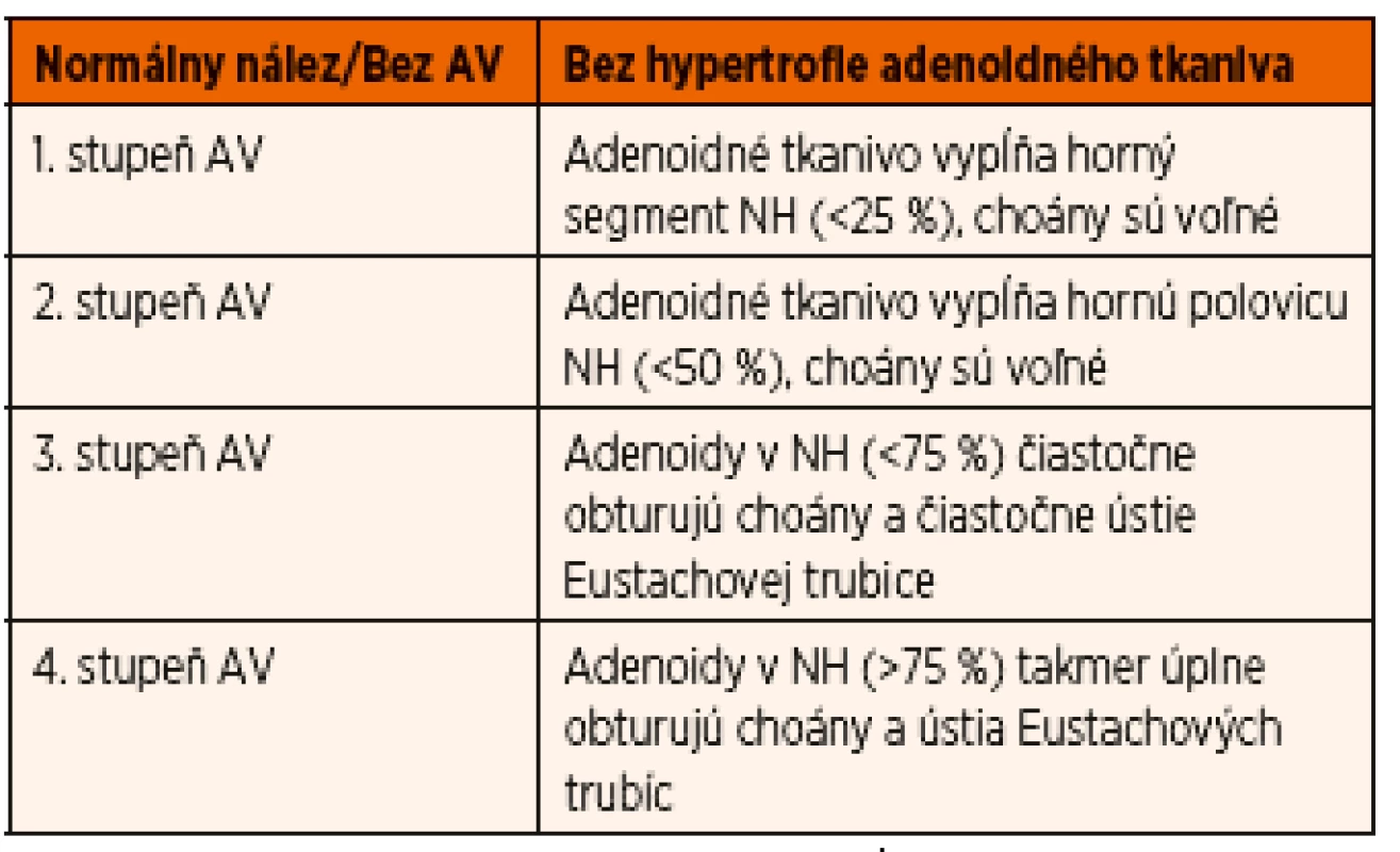 Klasifikácia stupňov hypertrofie adenoidných vegetácií.