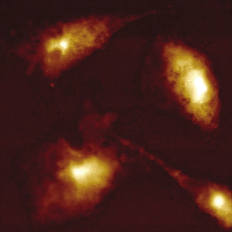 Buňka HeLa po fotodynamické terapii. Inkubace 6 h od ozaření (5 J.cm<sup>-2</sup>) při 37 °C a 5% CO<sub>2</sub>. Velikost skenu 53 × 53 μm. Výška neošetřené buňky – 4,2 μm, v ose x 25 μm, v ose y 21 μm. Světlá oblast udává největší výšku buněk. Skenováno v módu ScanAsyst bez chemické fixace. Skenovací rychlost 0,1 Hz.
