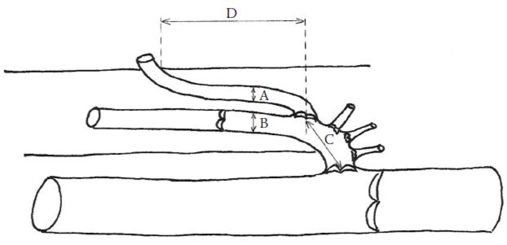 Výsledky měření anatomických parametrů PPVSM.