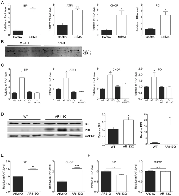 The UPR is activated in SBMA muscle.