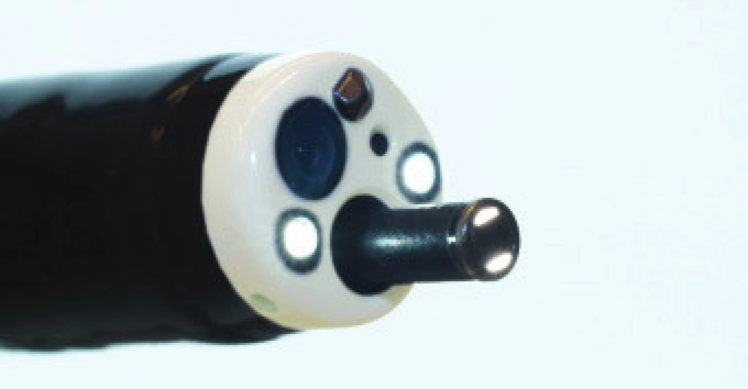 Endocytoskopická sonda v endoskopu.
