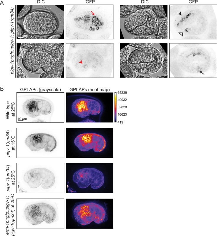 PIGV-1 is expressed in all embryonic epithelial tissues where it is essential for GPI-anchor biosynthesis.