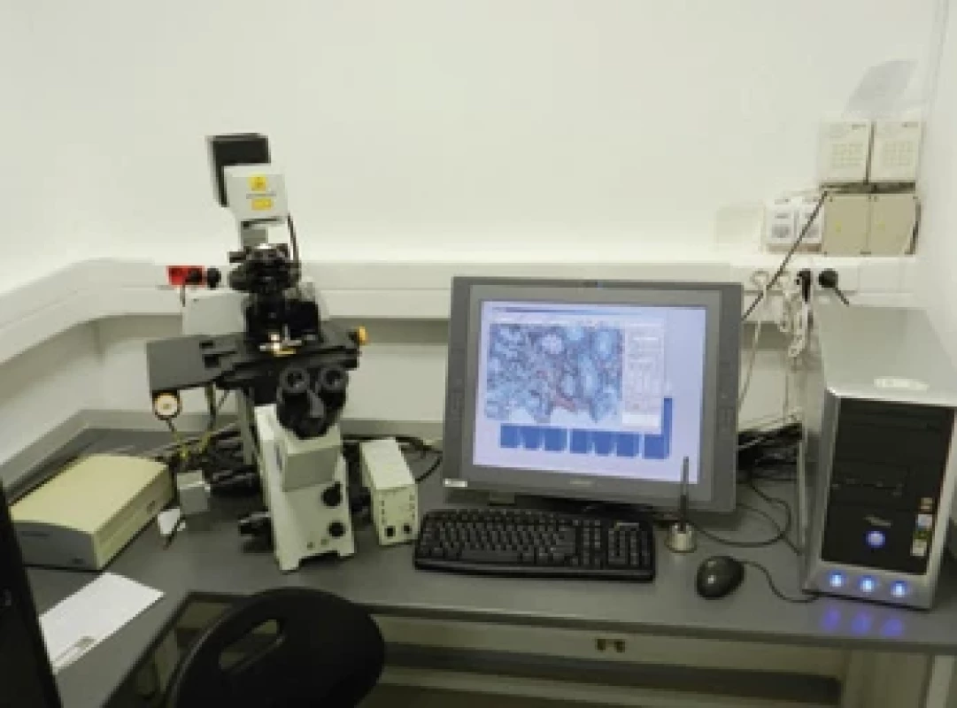 Laserový mikrodisektor (Ústavu Klinické a Molekulární Patologie LF UP Olomouc). Přístroj slouží k mikroskopické izolaci biologického materiálu, v rámci typizace amyloidu se získávají alikvóty depozit pro proteomickou analýzu.