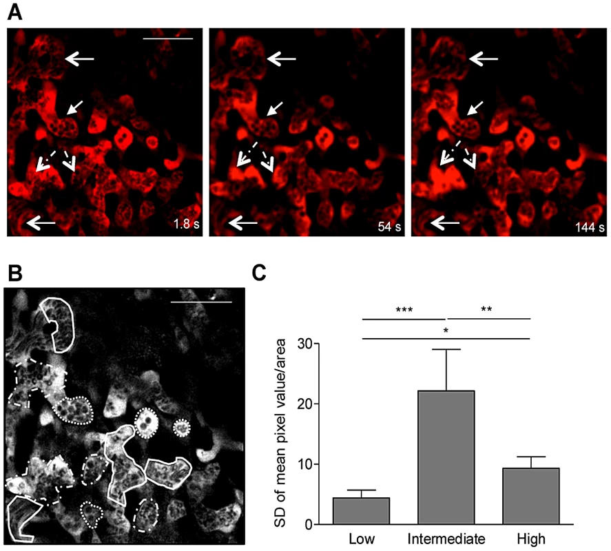 Blood flow heterogeneity in non-infected placenta.