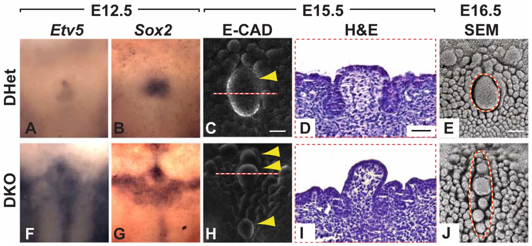 Formation of multiple CVPs in <i>Spry1<sup>−/−</sup></i>;<i>Spry2<sup>−/−</sup></i> (DKO) mice.
