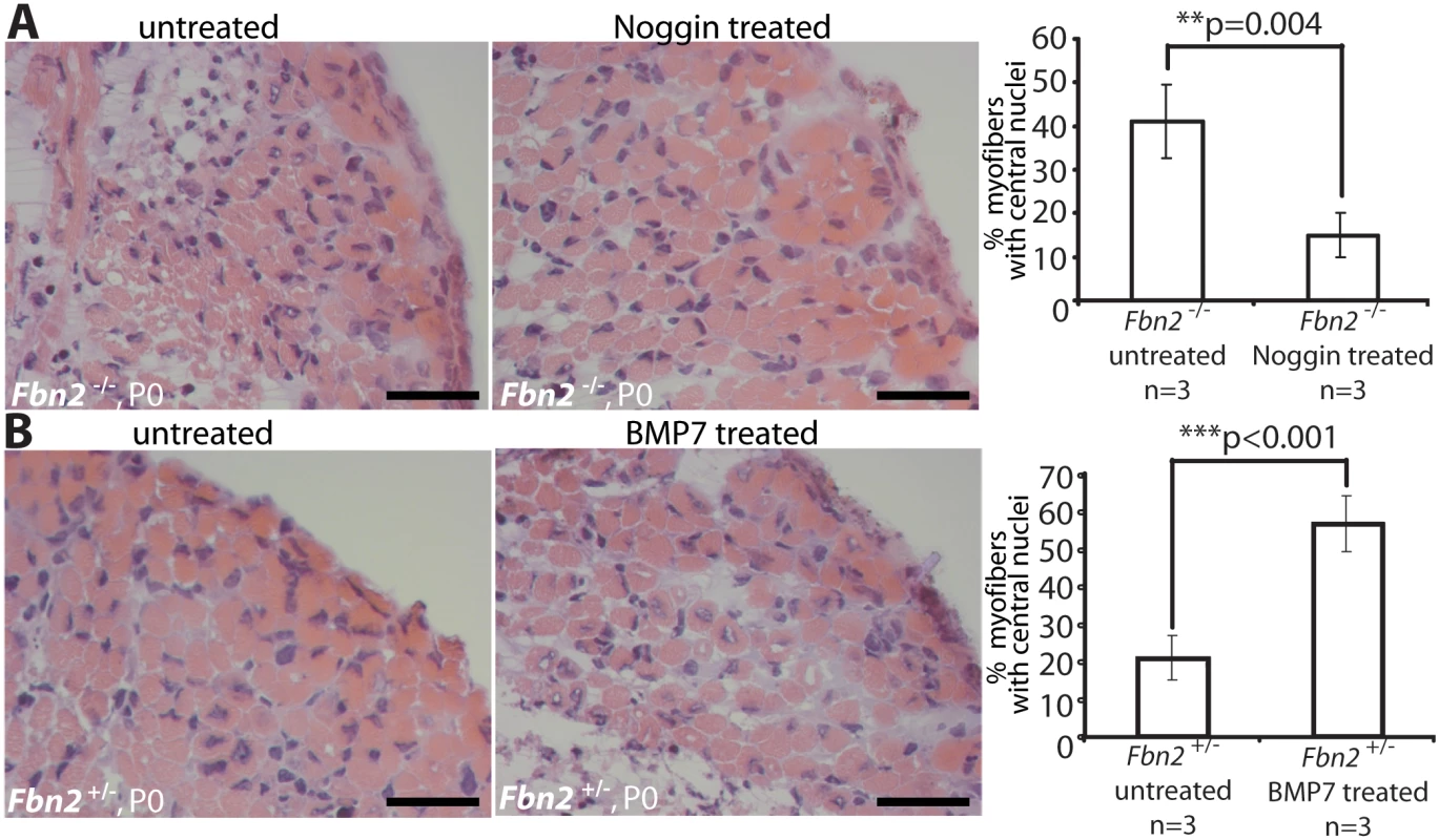 Limb organ cultures of heterozygous and <i>Fbn2</i> null forearm muscles.