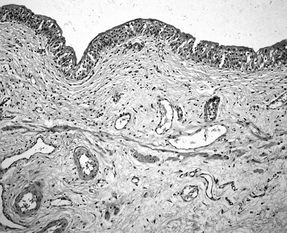 Muscularis mucosae v měchýři obklopená cévami středního kalibru. Sliznice kryta normálním urotelem (HE, 40krát)

