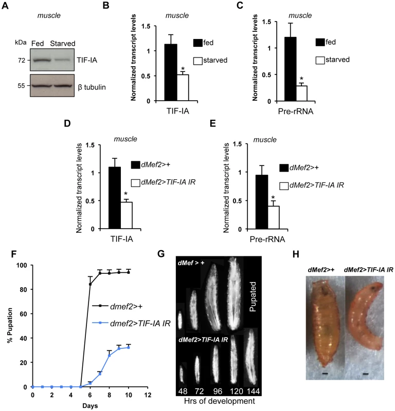 TIF-IA function is required in muscle to maintain overall body growth and development.