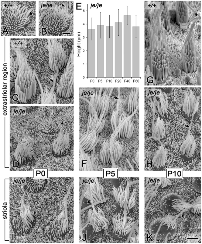 Morphogenesis defects and degeneration of vestibular hair cell stereocilia in utricular maculae of <i>je/je</i> mice.