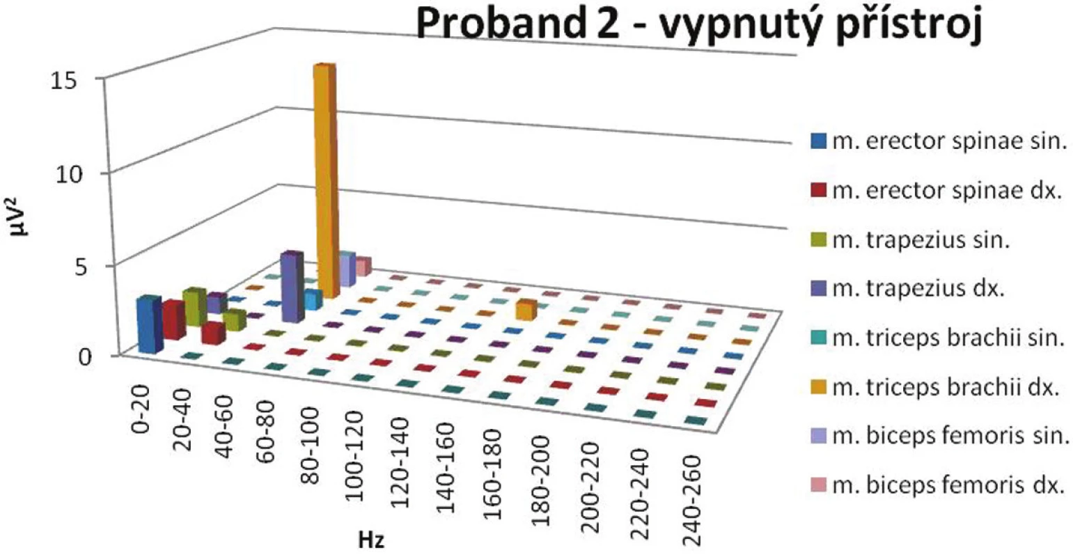 Zjištěná elektrická aktivita při vypnutém elektroterapeutickém přístroji.
