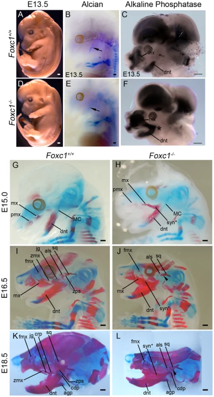 Time-course of PA1-derived skeletal abnormalities in <i>Foxc1<sup>−/−</sup></i> mice.