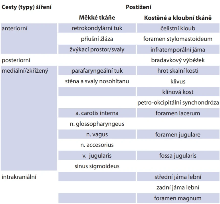  Cesty šíření nekrotizujícího zánětu zevního zvukovodu (upraveno dle Kwona et al.) [17]. Tab. 1. Spreading patterns of necrotizing external otitis (Kwon et al. classifi cation modifi cation) [17].