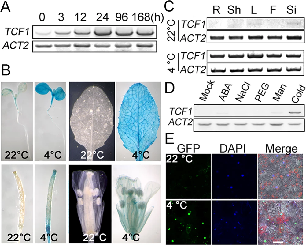 Analysis of <i>TCF1</i> expression and nuclear localization of the TCF1 protein.
