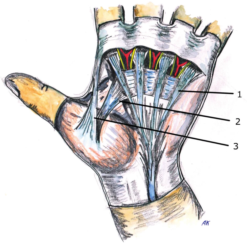 Anatomy of palmar aponeurosis
1. Longitudinal pretendinous fibers
2. Proximal commisural ligament of 1<sup>st</sup> web space
3. Distal commisural ligament of 1<sup>st</sup> web space