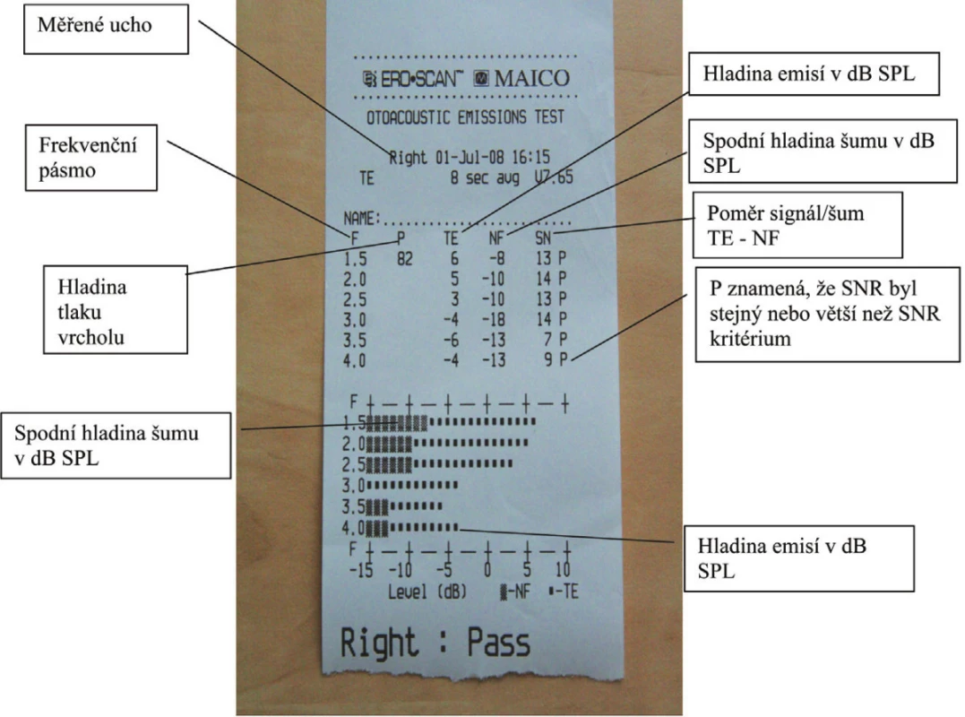 Interpretace testu.