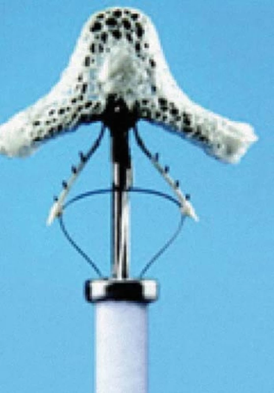 MitraClip.