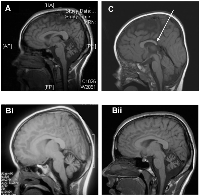 Neuroimaging of patients.