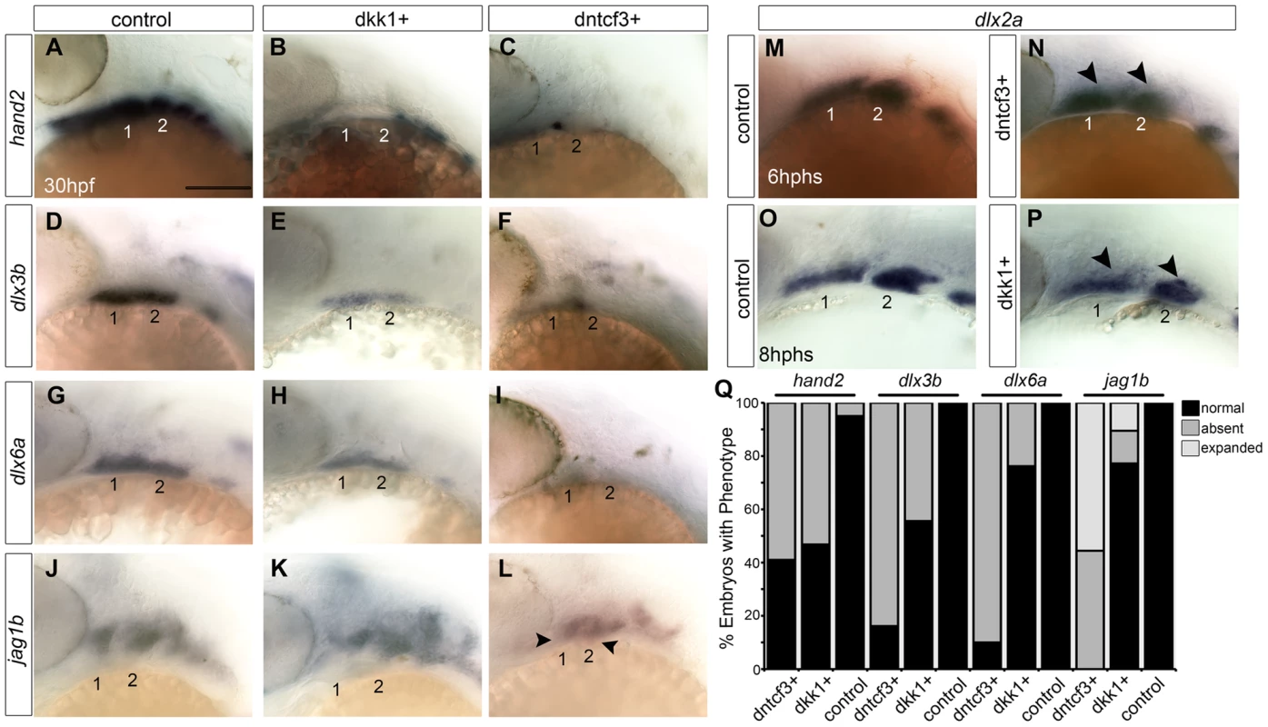 Requirements for Wnt signaling in dorsal-ventral arch patterning.